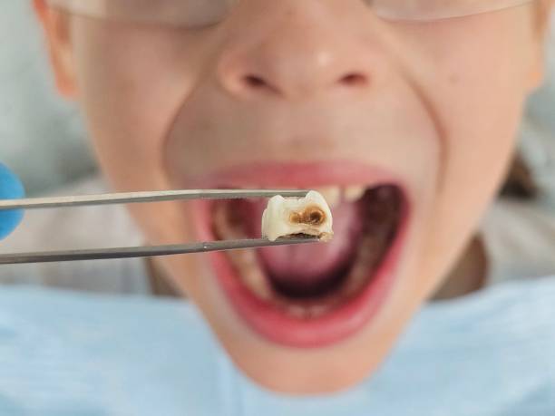 Best 24-Hour Emergency Dentist in Crandall, TX