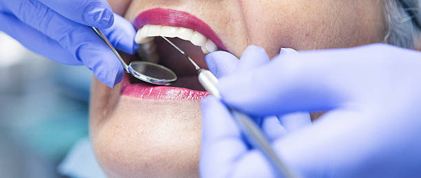 Best Emergency Treatment for Dental Infections or Abscesses in Crandall, TX